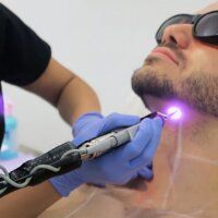 Лазерная трансформация: Почему современный мужчина выбирает технологичную гладкость