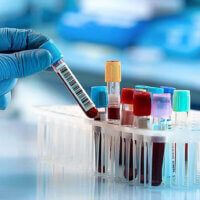 Чому важливо здавати аналізи вчасно