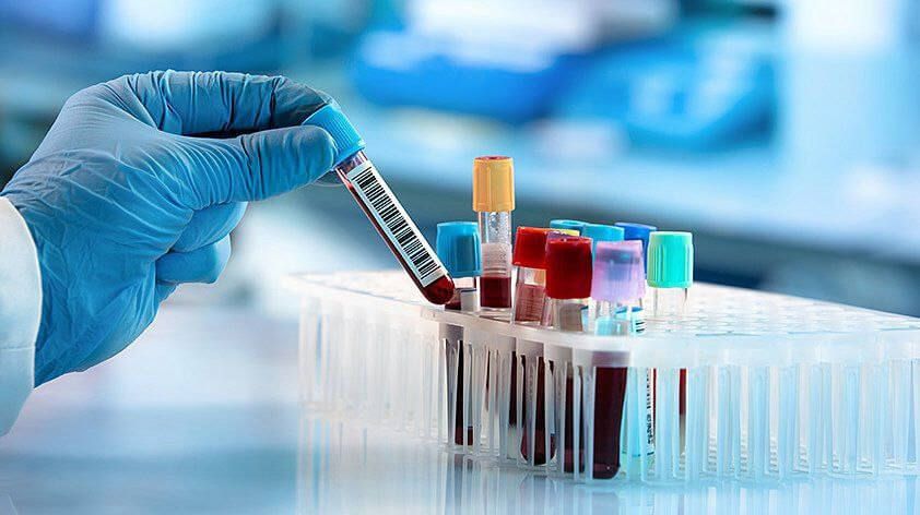 Чому важливо здавати аналізи вчасно